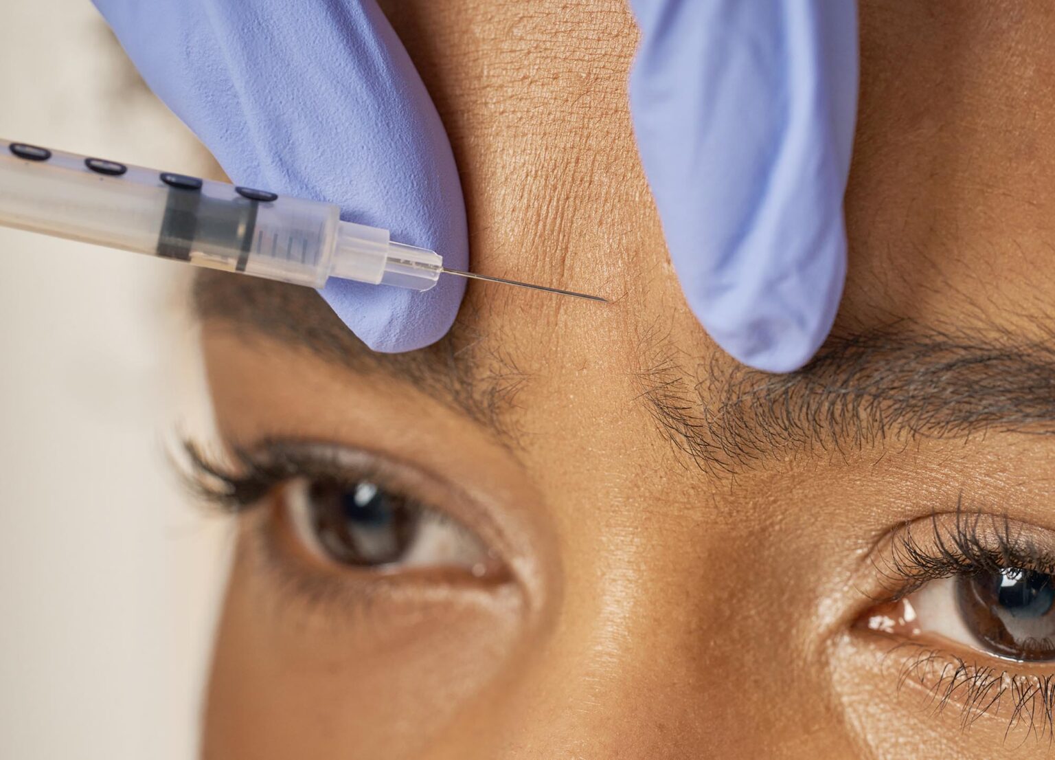 Do you know the optimal injection depth of Botox?