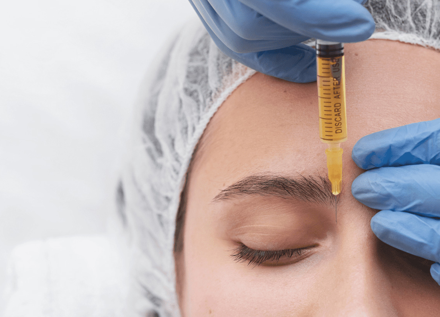 What are the injection techniques for mesotherapy?