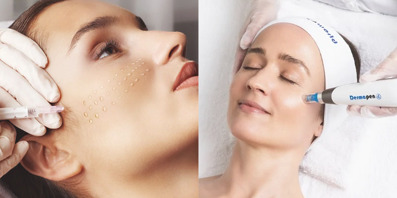 difference between dermapen and meso needle.jpg