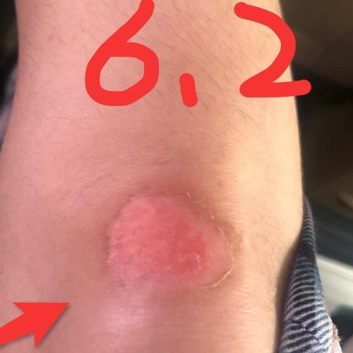 moist healing 2.png