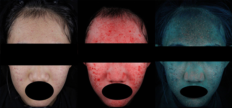 facial test.jpg